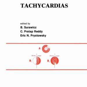 Developments in Cardiovascular Medicine- Tachycardias